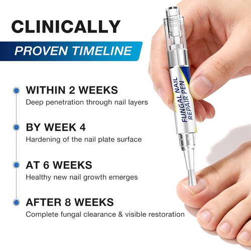 AntiFung Pen by Toenail Fungus Treatment - Extra Strength with 25% Undecylenic Acid - 3-Pack for Effective Nail Repair