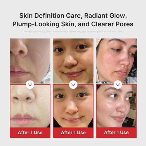 medicube Booster Pro | 6-in-1 Real Glass Glow Beauty Massager | for Clear, Radiant, Firmer-Looking Skin | Korean Skin Care