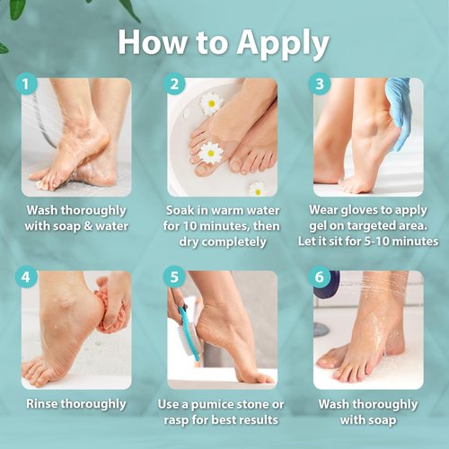 Ebanel Professional Callus Remover for Feet with 20% Urea, Epsom Salt, Salicylic Acid, Glycolic Acid, Heel Toe Foot Callus Remover Gel Peel Exfoliator Dead Skin Removal for Feet, Cracked Heel Repair