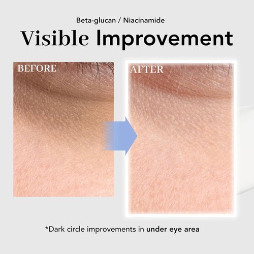 NOWATER Collagen Eye Cream - Reduces Wrinkles, Puffiness & Dark Circles | Hydrolyzed Collagen, 0.88 fl. oz.