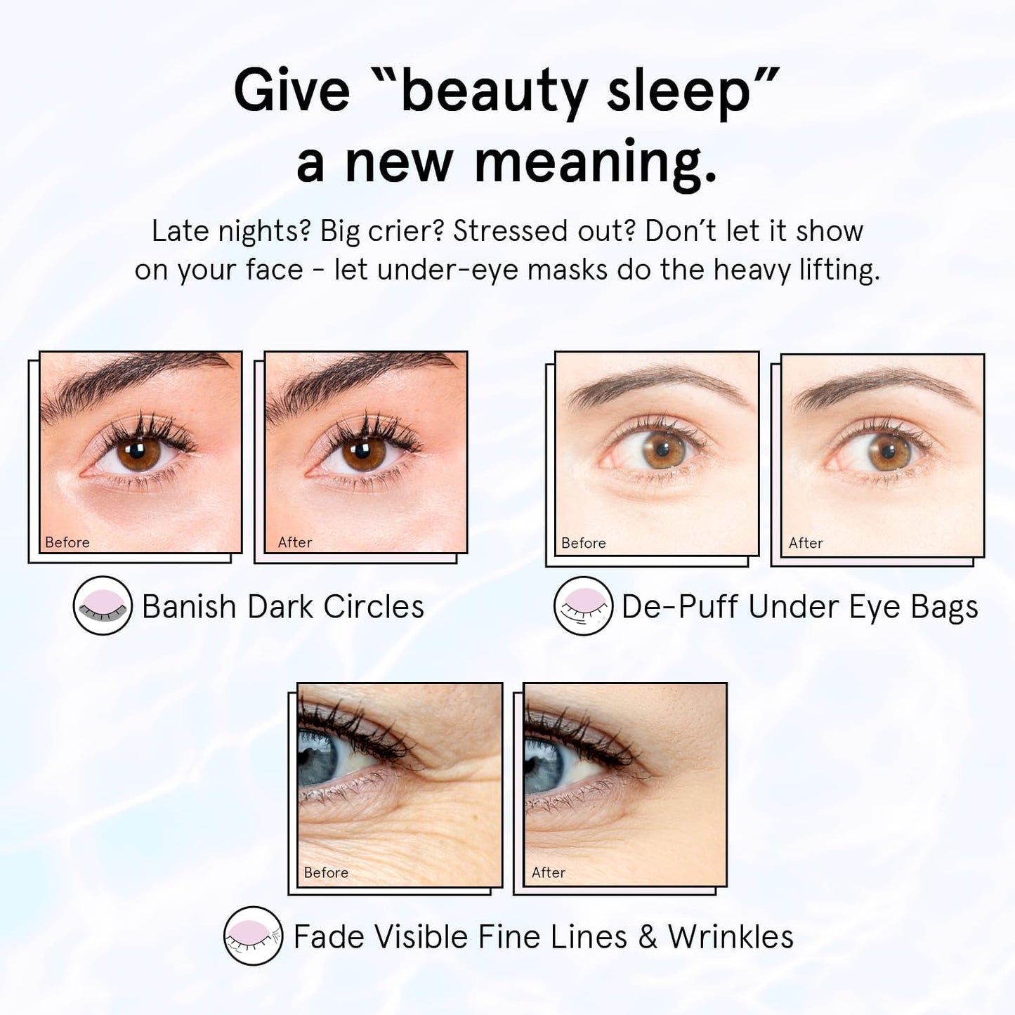 Grace & Stella Retinol Under Eye Patches - Reduce Puffiness & Dark Circles | Vegan Gel Masks (Purple, 6 Pairs)
