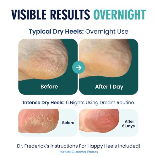 Dr. Frederick's Moisturizing Heel Socks - Olive Oil & Vitamin E Infused for Dry Cracked Heels - 2 Pairs - Green Aloe