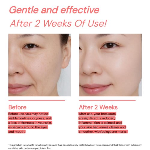 18% Active Anti-Aging Serum – 10% Pro-Xylane, 1% Retinol, 5% Squalane & Peptide Complex for Firmer, Smoother Skin