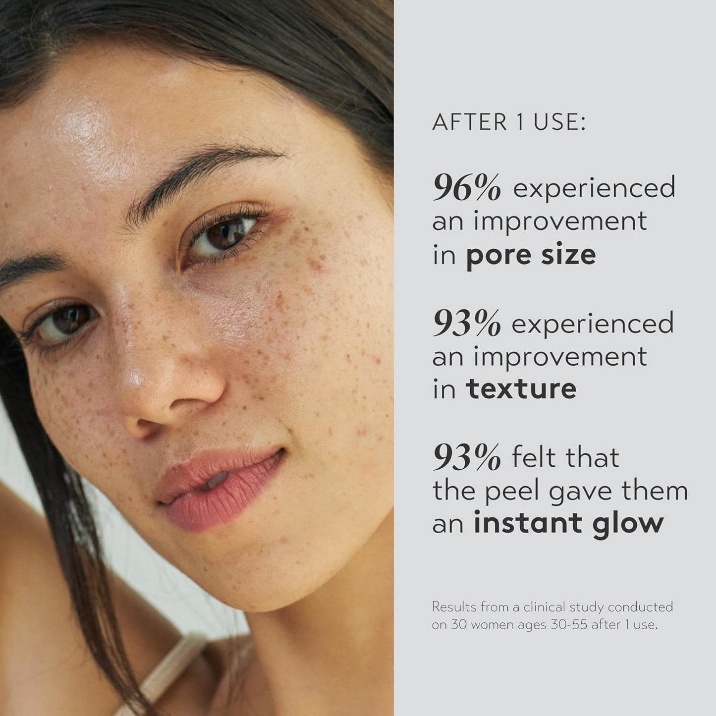 SHANI DARDEN SKIN CARE Triple Acid Peel - 2-Step Exfoliating Treatment with Mandelic, Lactic & Glycolic Acids | Includes Neutralizing Mask & Brush (0.5 fl oz)