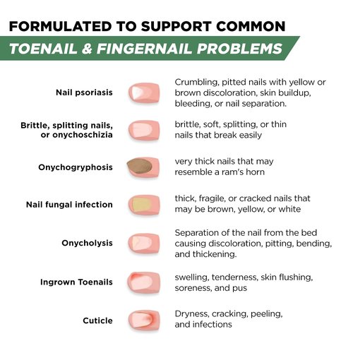 Foot Cure Toenail Fungus Treatment - Extra Strength Nail Repair with Tea Tree & Oregano Oil | Made in USA