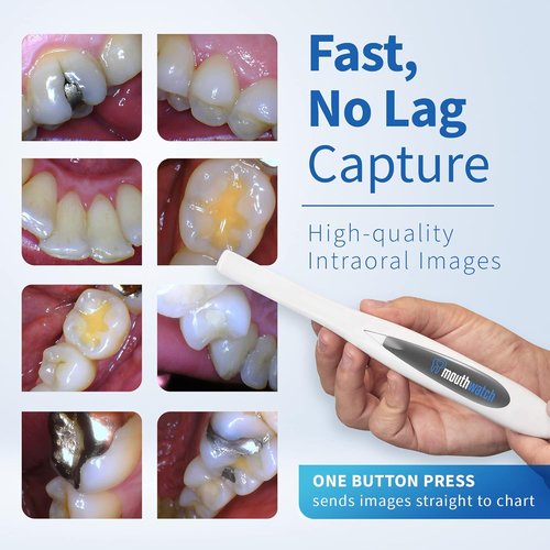 Intraoral Camera by [Brand Name] - Crystal Clear Images | Lightweight & Ergonomic Design, Easy One-Button Operation