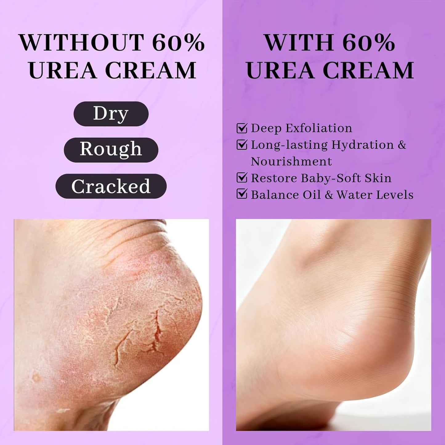 Urea Cream 60% by Skiennix - Maximum Strength 5-in-1 Moisturizer for Rough, Dry Skin | 150g