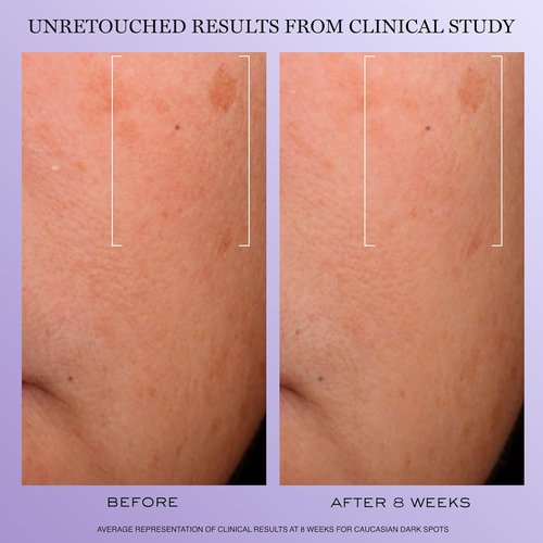Lancôme Rénergie H.C.F. Triple Serum - Anti-Aging Hyaluronic Acid Serum with Vitamin C+, Niacinamide & Ferulic Acid - 1.0 oz
