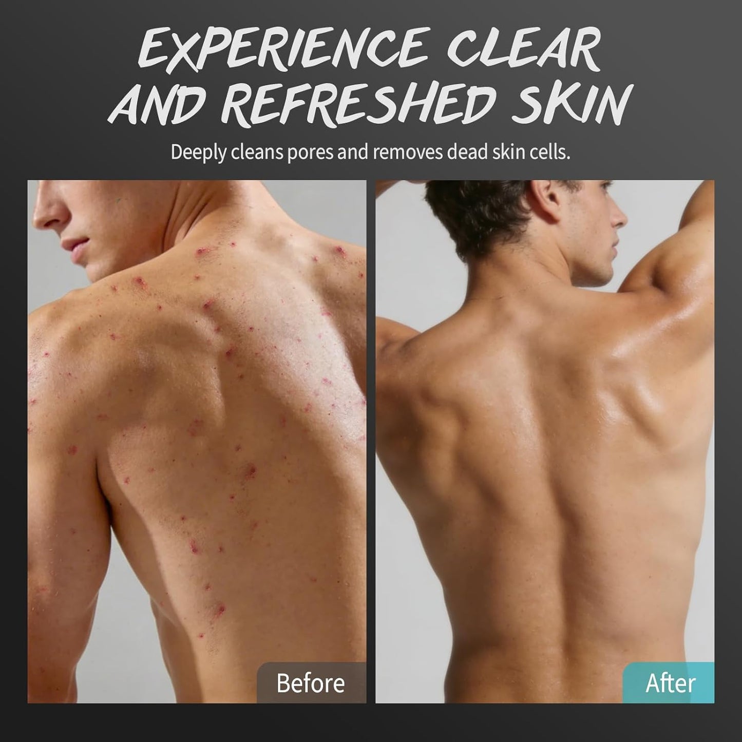 Skiennix Men's Body Scrub - Exfoliating Tea Tree Oil Formula for Smooth Skin | 10% AHA, 2% BHA