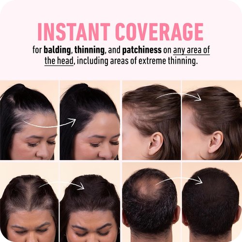 BOLDIFY Hairline Powder (LARGE, 10g) - Water-Resistant Root Touch Up Hair Color for Gray Coverage - 24-Hour Stain-Proof, Mess-Free Hair Powder for Thinning Hair - Dark Gray