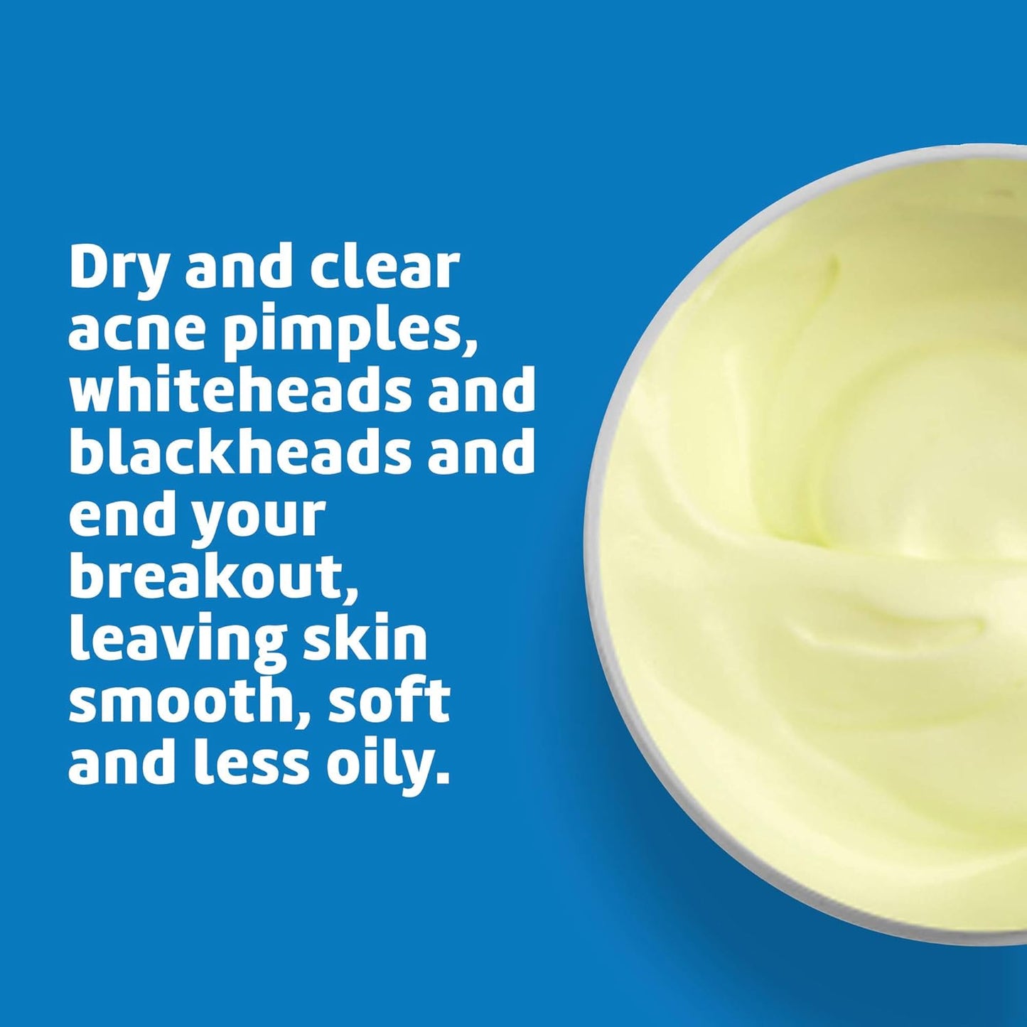 De La Cruz Sulfur Ointment - Effective Cystic Acne Treatment for Face & Body - 5.5 OZ Daily Spot Mask