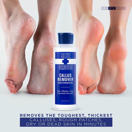 Blue Cross Callus Remover Gel - Extra Strength Foot Care for Smooth Heels | 6oz