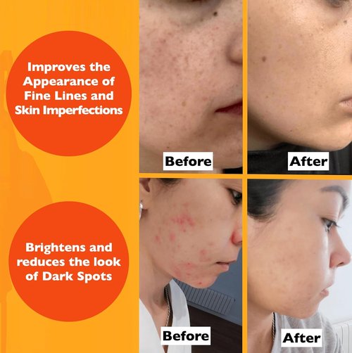 Regine Switzerland Vitamin C Serum - Anti-Aging Formula with Hyaluronic Acid & Vitamin E | 2 Fl Oz for Glowing Skin