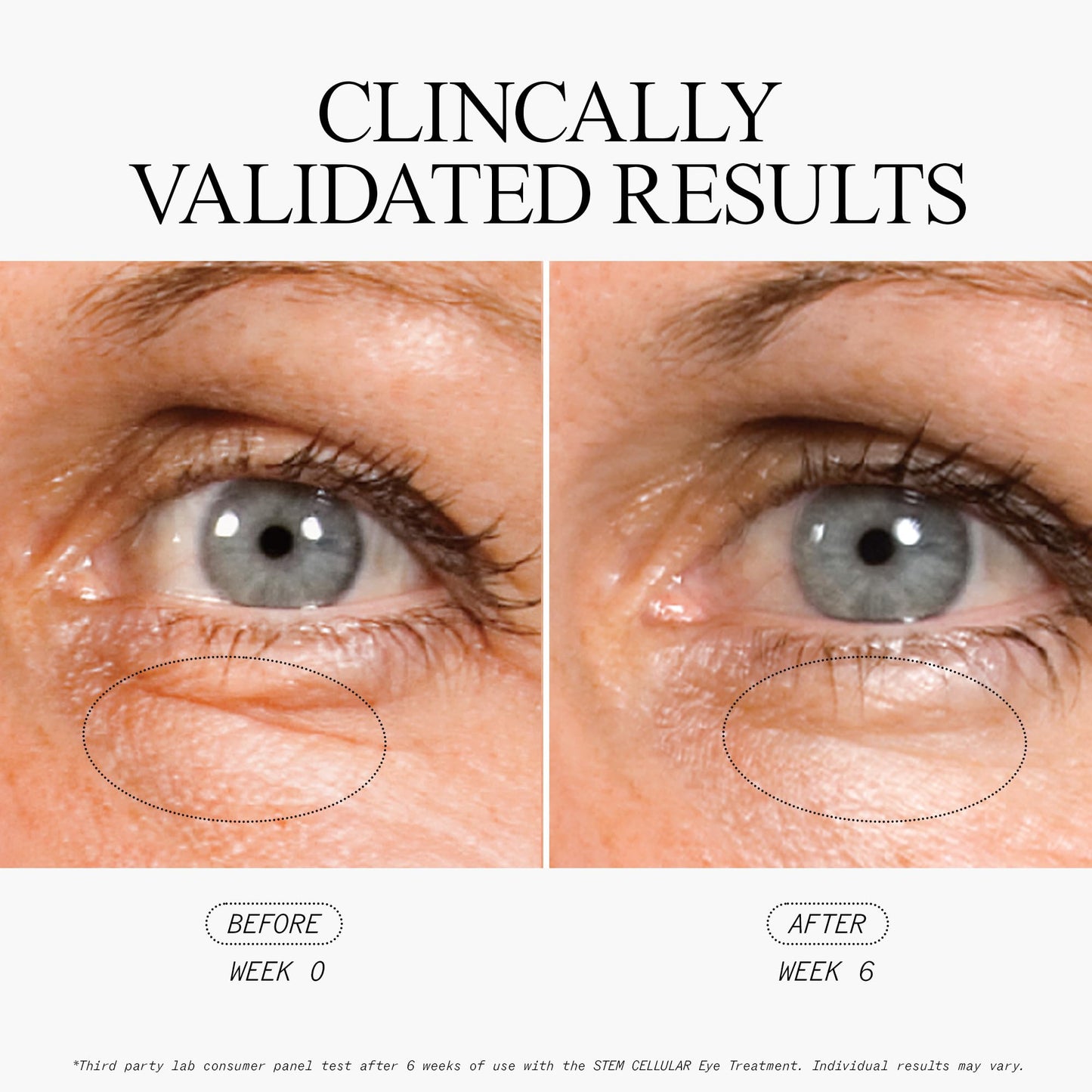 Juice Beauty Stem Cellular Anti-Wrinkle Eye Treatment - 15 mL - Reduces Look of Fine Lines + Dark Circles - Vegan, Cruelty Free