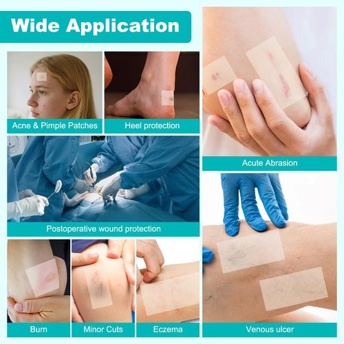 Hydrocolloid Roll for Wound Care, Hydrocolloid Bandages with Self-Adhesive, Cut-to-Size Patch Bandages, Ultra Absorbent, Waterproof, First Aid Kit Essential (2IN*4.8FT)