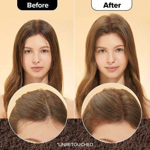 I DEW CARE Biotin Clarifying Dry Shampoo - Medium Brown Powder | Strengthening & Volumizing, Travel Size 0.25 Oz