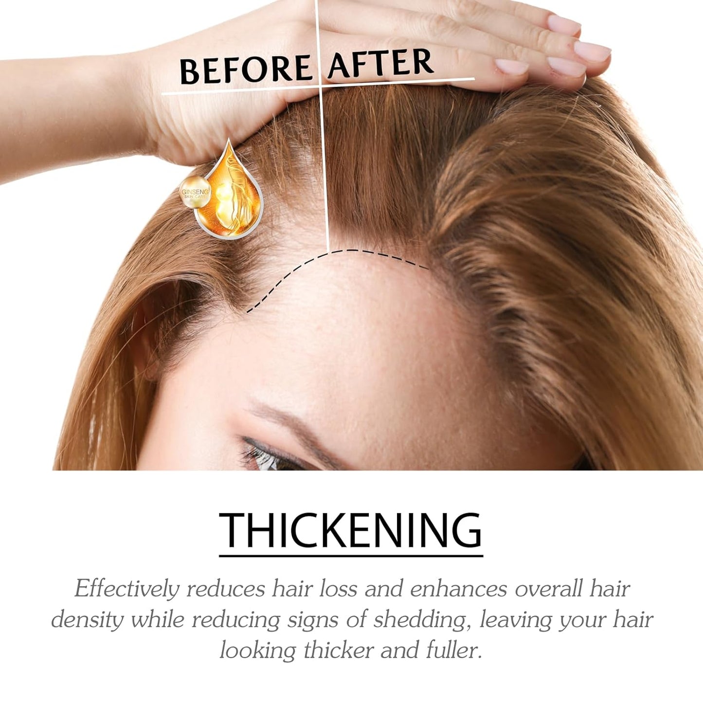 Skiennix Hair Ampoule Treatment Serum - Strengthening Nourishing Concentrate for Thinning Hair | 7 Count