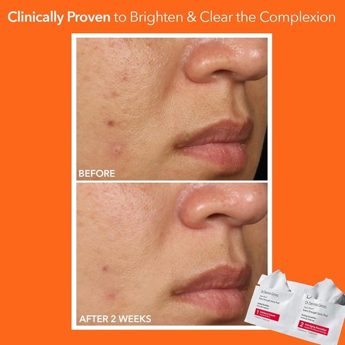 Dr. Dennis Gross Alpha Beta Daily Peel - Extra Strength for Oily Skin, Uneven Tone & Wrinkles (30 Treatments)
