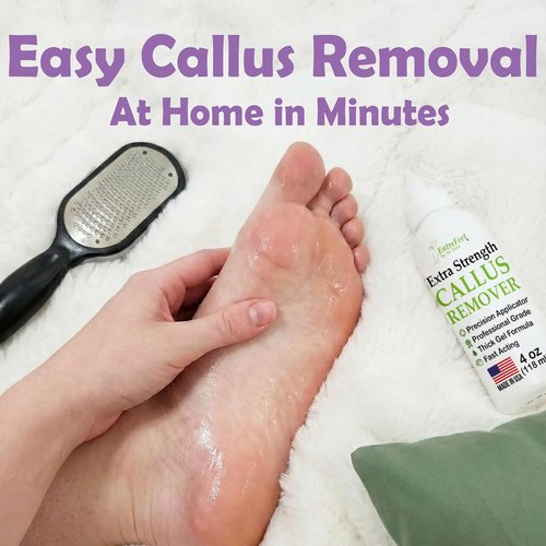 Dr. Entre's Callus Remover Gel - Extra Strength Foot Care & Pedicure Tools | 4 oz Spa Kit