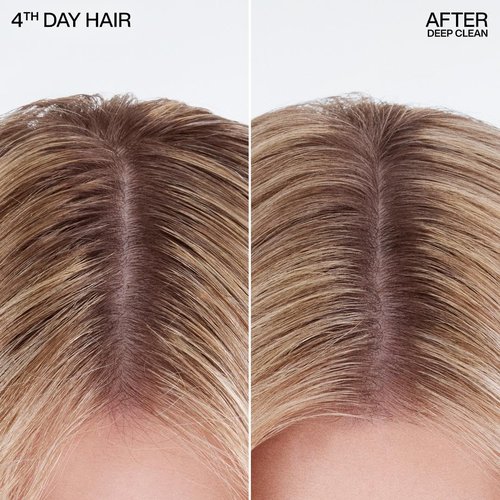 Redken Deep Clean Dry Shampoo - Refreshes All Hair Types, Absorbs Oil Without Buildup | Dark or Light Hair