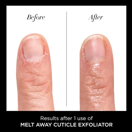 butter LONDON Cuticle Remover Liquid - Fast-Acting Cuticle Oil Exfoliator for Healthy Nails - 0.4 Fl Oz