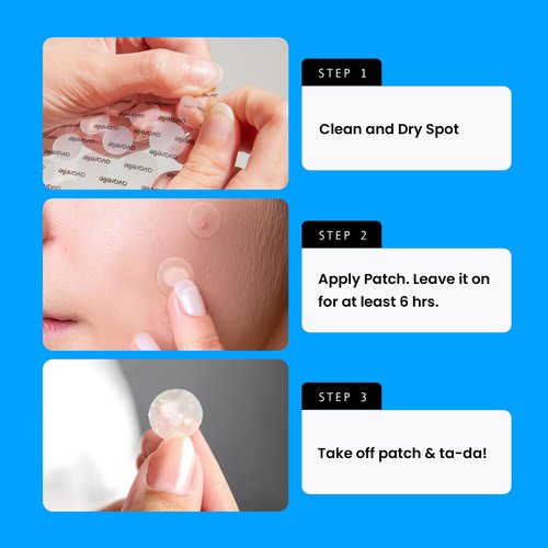 AVARELLE Pimple Patches for Face | Hydrocolloid Acne Patches for Covering Blemishes | Zit Patches with Tea Tree, Calendula, & Cica | HSA Store Eligible Items (10-14 mm, 80 Count)