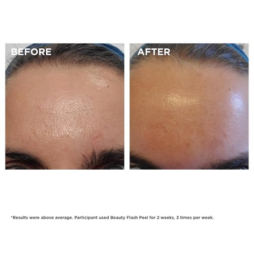 Clarins Beauty Flash Peel - 10-Minute At-Home Facial for Radiant Skin | Refines Texture & Tightens Pores