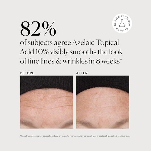 Naturium Azelaic Acid 10% | Brightening Face Treatment with Niacinamide & Vitamin C - 1 oz