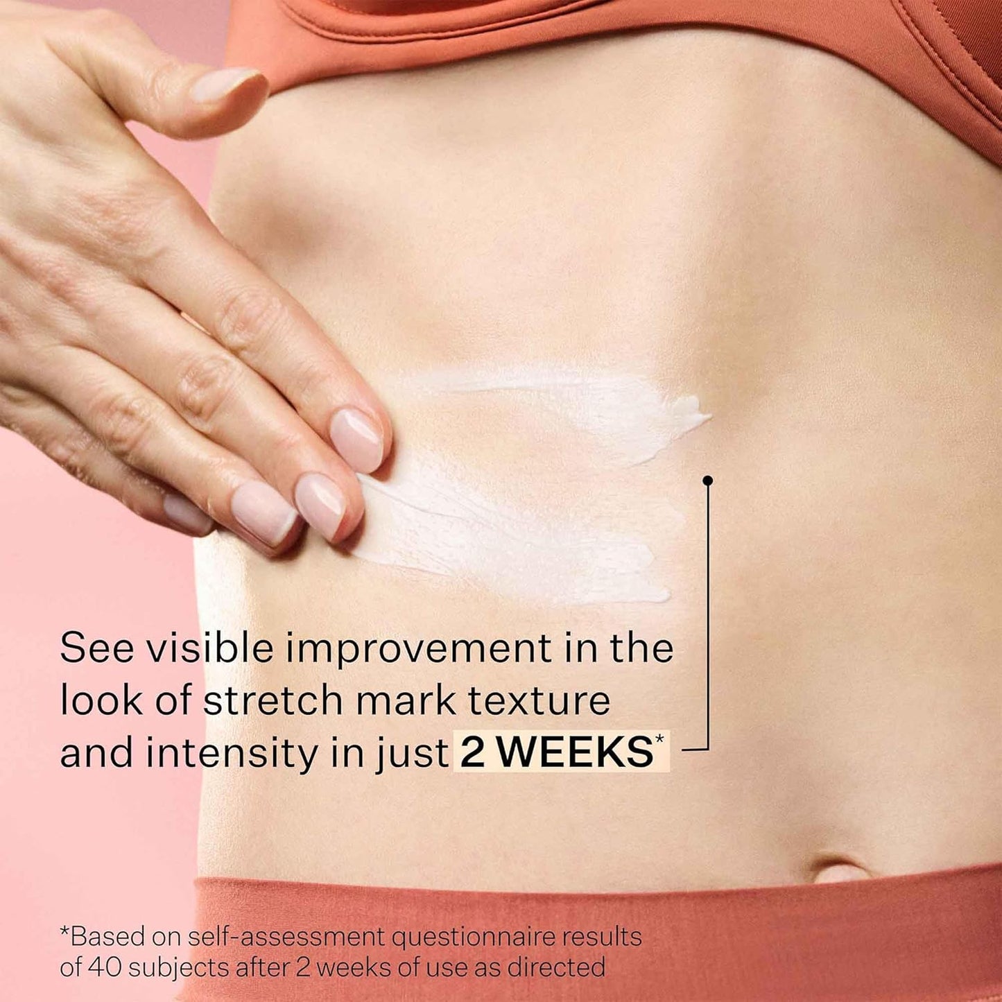 StriVectin SD Advanced Plus Intensive Moisturizer - Collagen Boosting for Wrinkles & Stretch Marks | Face & Body