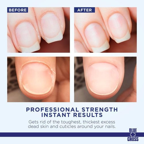 Blue Cross Cuticle Remover & Softener Liquid - Hydrating Treatment for Dry Cuticles, 6oz