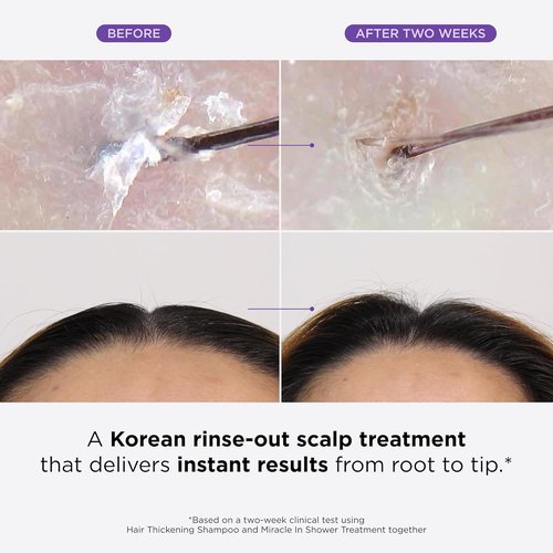 Dr. Groot Miracle In Shower Hair Treatment - Rosemary Oil Rinse for Healthy, Smooth Hair | 5 Seconds