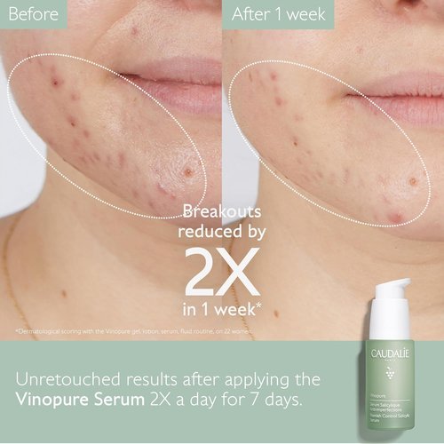 Caudalie Vinopure Pore Minimizing Serum - Natural Salicylic Acid & Niacinamide | 30 mL