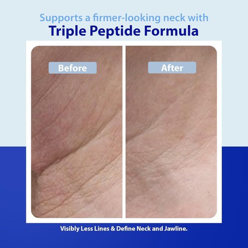 Dr. Denese Triple Strength Neck Wrinkle Smoother 4 oz | Firming Cream with Peptides & Retinol for Hydration
