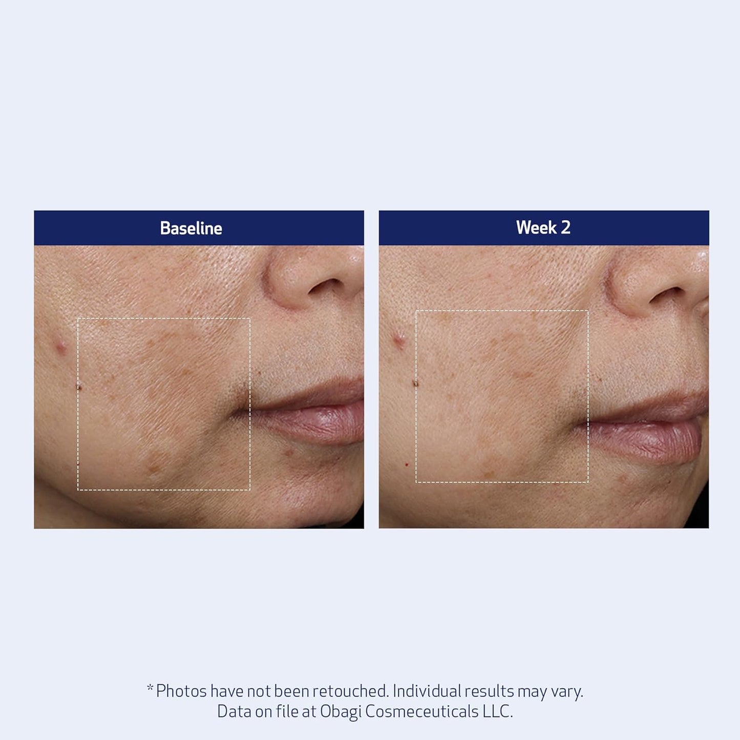 SUZANOBAGIMD Super Antioxidant Serum - Reduces Fine Lines & Wrinkles, Brightens Skin Tone - 1 oz