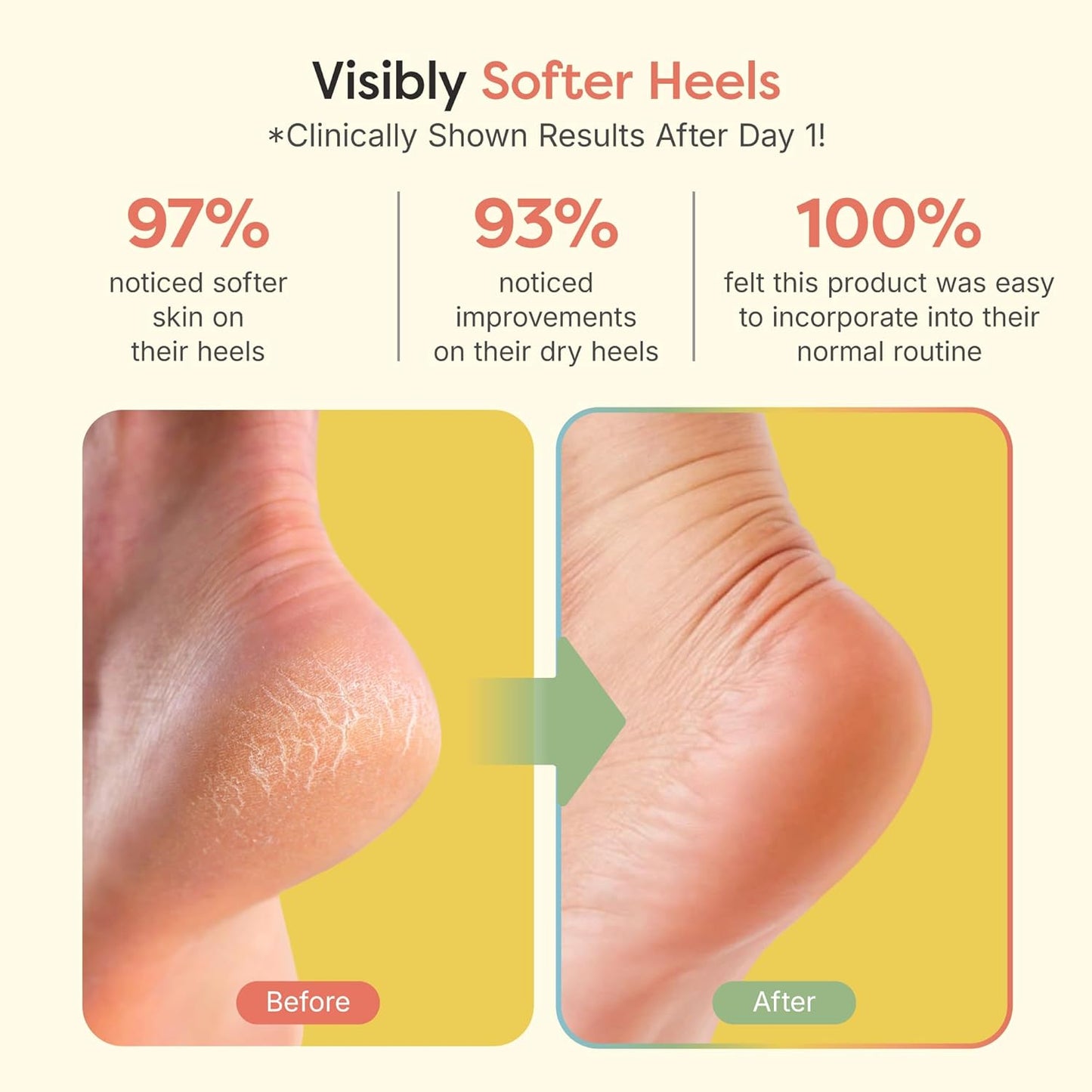 ZenToes Moisturizing Heel Socks - Cracked Heel Treatment with Vitamin E & Olive Oil | Fuzzy Lilac Purple, Regular Size