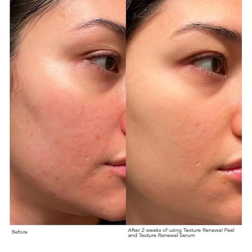 Dr. Dennis Gross Advanced Retinol Serum - Anti-Aging Formula to Smooth Texture & Boost Radiance, 1 oz