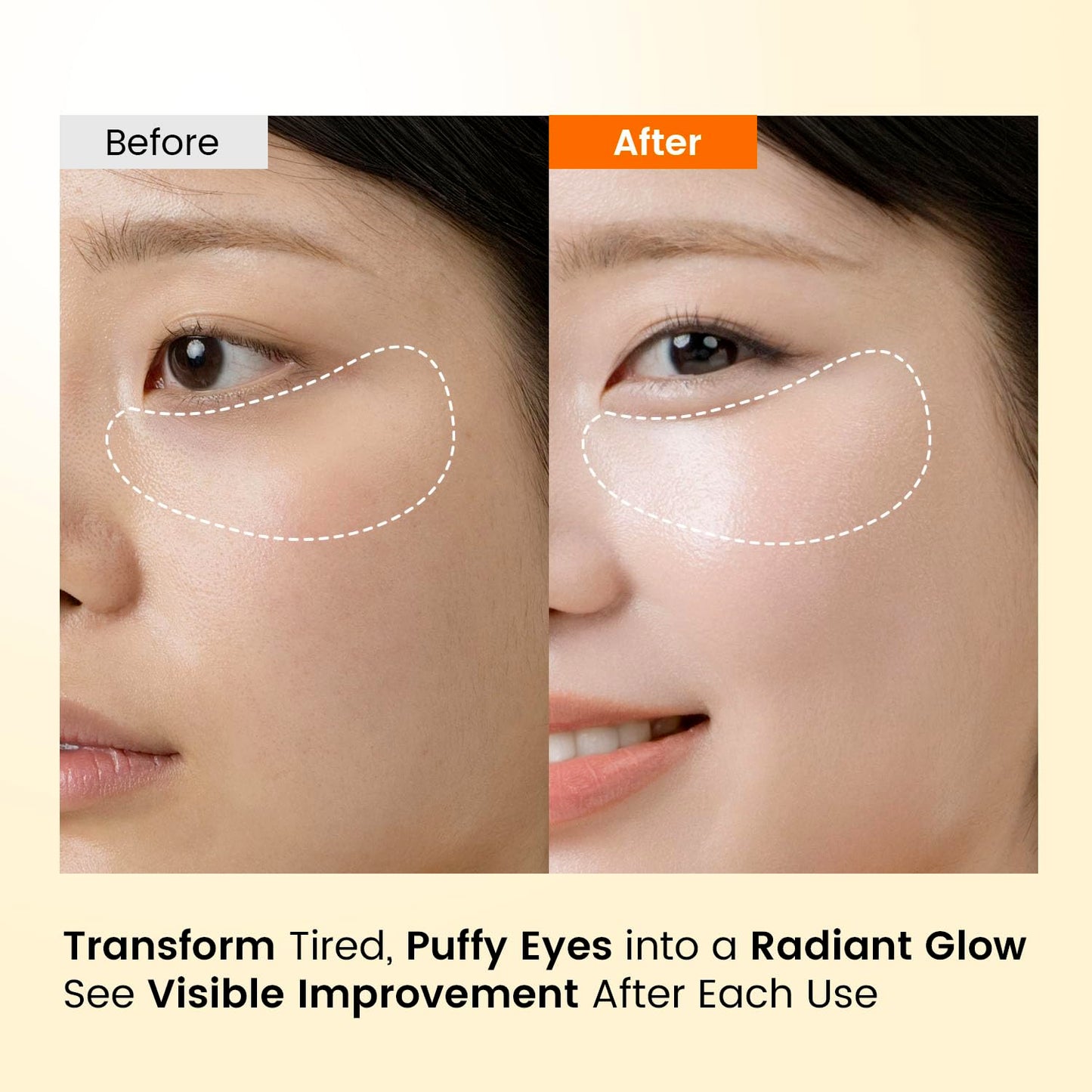 Skiennix Caffeine Under Eye Patches - 30 Pairs Korean Hydrogel Masks for Dark Circles & Puffiness Relief