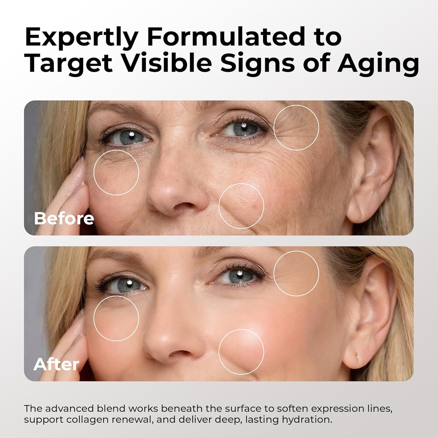 SKIN DEVA 20% Argireline Serum - Deep Wrinkle Reducer with Matrixyl 3000 & Pure Hyaluronic Acid