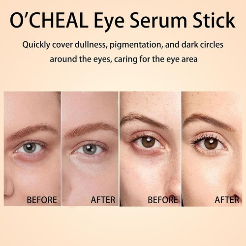 O'CHEAL Eye Serum Stick - Hydrating & Nourishing Formula | Brightens, Tightens, Reduces Dark Circles
