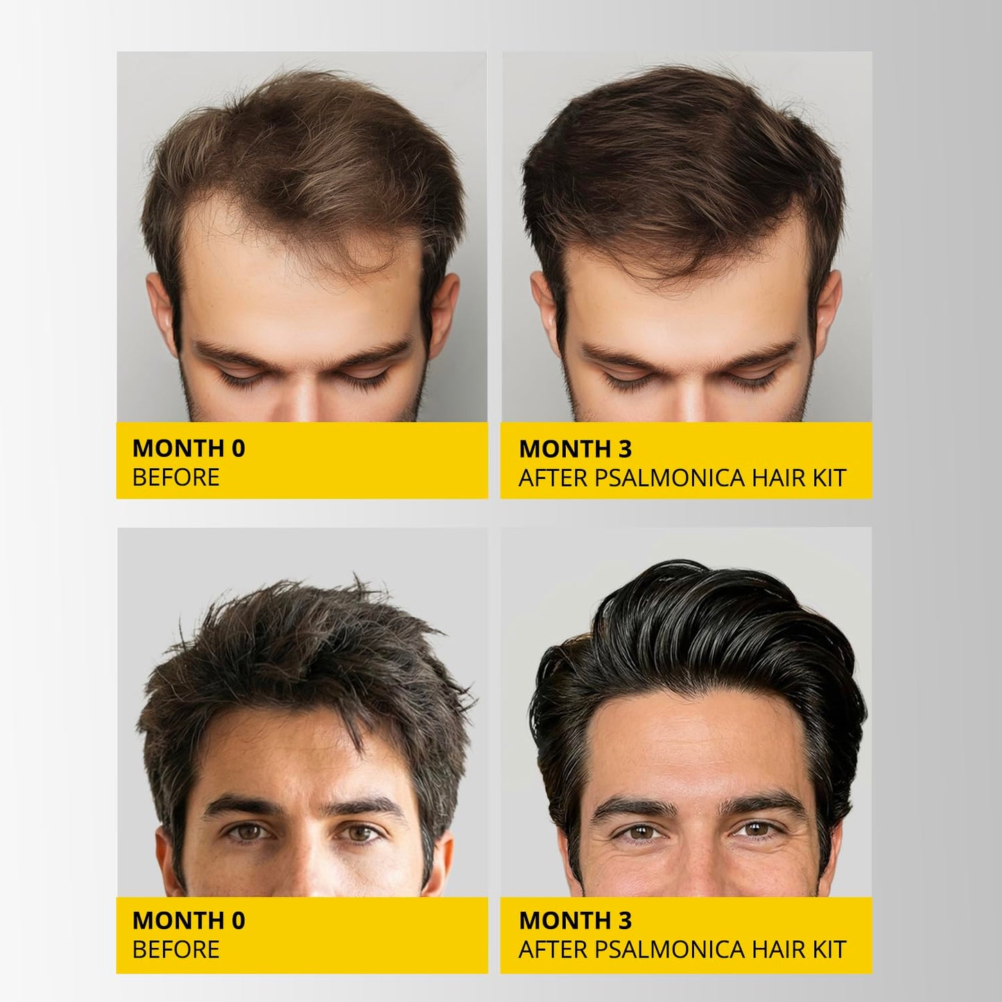 Skiennix Hair Growth Shampoo & Conditioner Set - Sulfate-Free Thickening Formula for Hair Loss & Thinning Hair