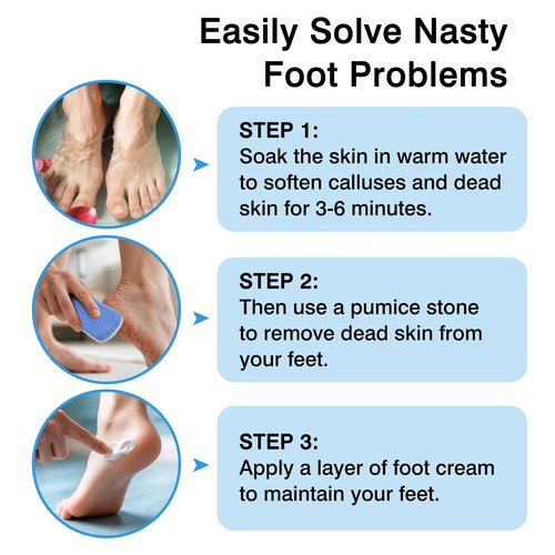Durable Callus Remover & Dual-Sided Foot Scrubber for Exfoliation and Pedicure ，2-Pack Glass Pumice Stones