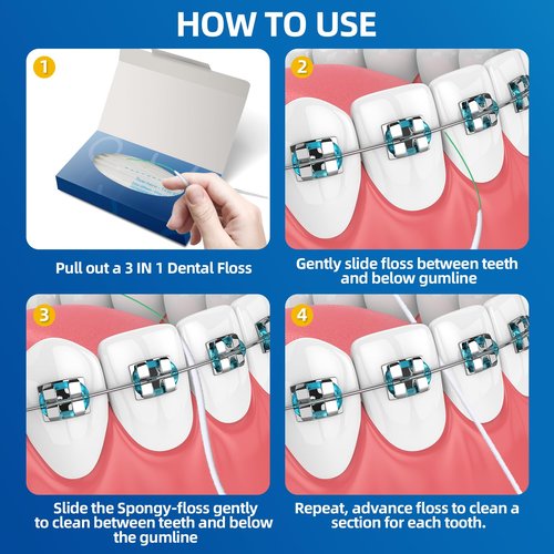Bopika 3-in-1 Dental Floss for Braces & Bridges, Pre-Cut Strands – Built-in Threader & Thick Spongy Floss for Orthodontic Care – Easy Reach for Gaps & Appliances