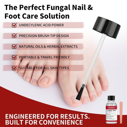 Regine Switzerland Toenail Fungus Treatment - Extra Strength Antifungal Nail Repair with Undecylenic Acid | 30ml
