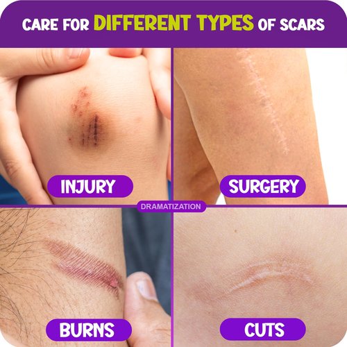 Cicatricure Advanced Scar Gel - Gentle Formula for Kids to Improve Scar Appearance | 1 oz Grape Scent