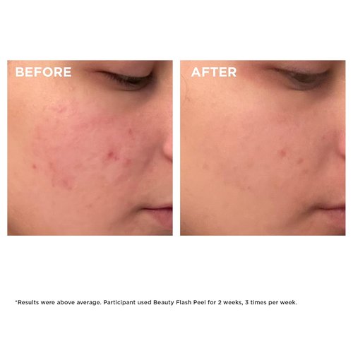 Clarins Beauty Flash Peel - 10-Minute At-Home Facial for Radiant Skin | Refines Texture & Tightens Pores