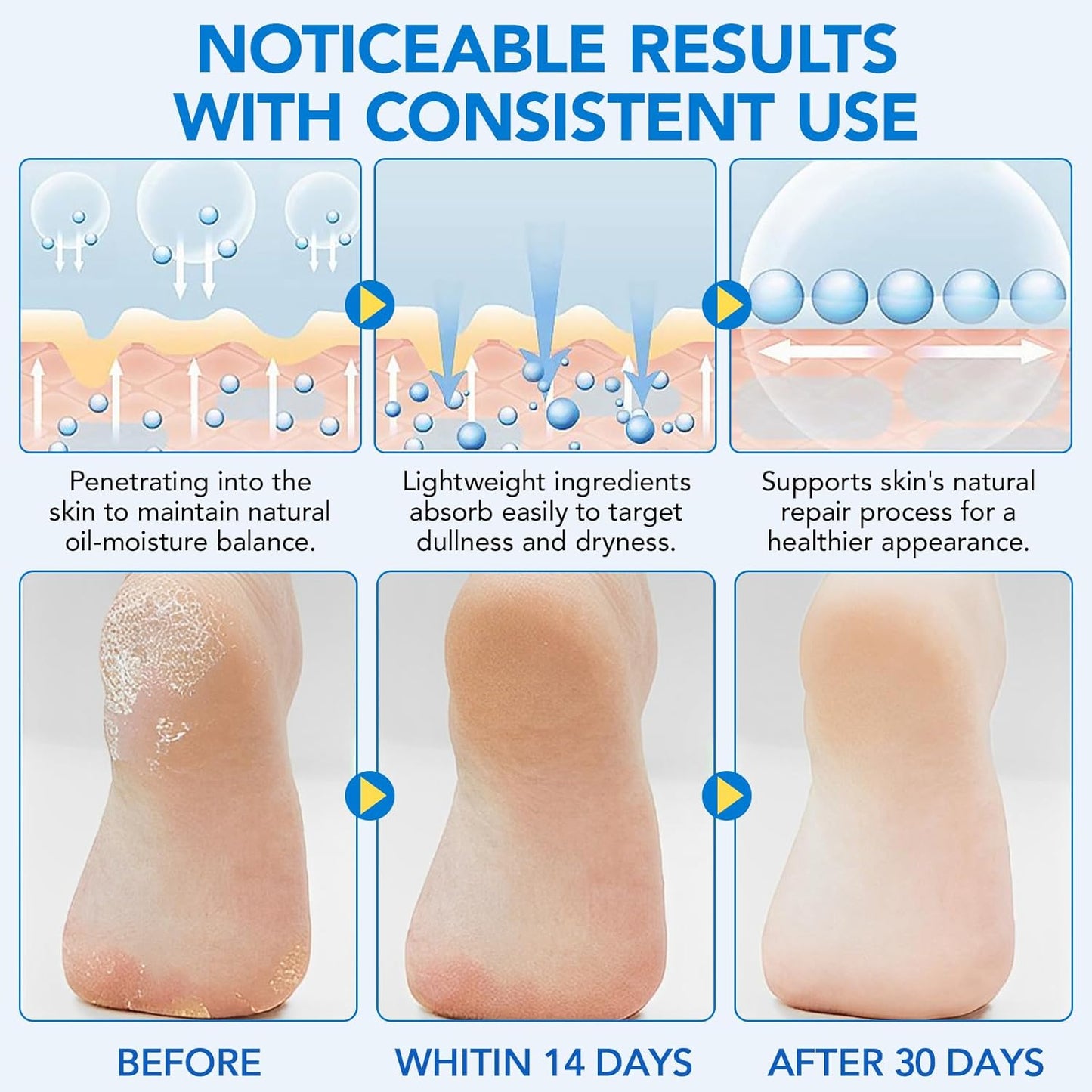 Skiennix Urea Foot Cream Stick - 60% Urea & 2% Salicylic Acid for Dry Cracked Skin | 1.41 oz Hydrating Moisturizer