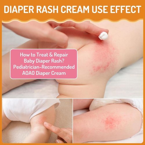 Regine Switzerland Baby Diaper Rash Cream - Instant Relief for Diaper Rash & Skin Discomfort | 100ml/3.38oz