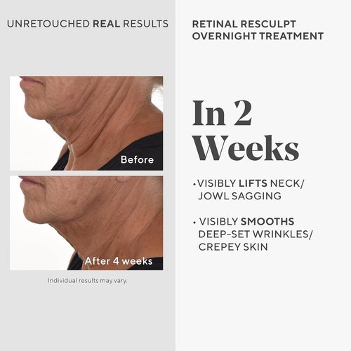 Murad Retinal ReSculpt Overnight Treatment - Advanced Face & Neck Serum for Deep Wrinkles & Sagging Skin