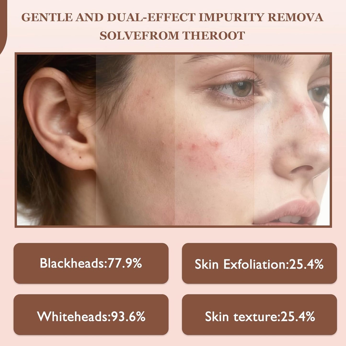Skiennix Rice Peel Shot Glow Ampoule Duo - Pore Minimizing Gentle Peel & Deep Hydration | 6.76 Fl Oz, 2 Pcs