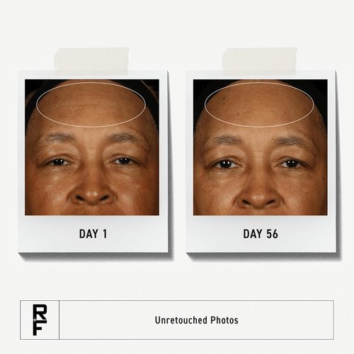 Rodan + Fields Redefine Pore Minimizing Toner - Glycolic Acid Exfoliant for Smoother Skin | 4.2 fl oz